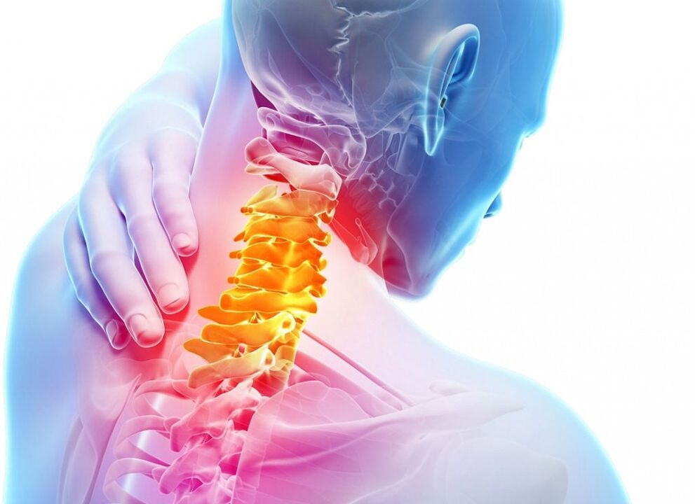 Cos'è l'osteocondosi cervicale
