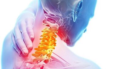 Cause di osteocondosi cervicale