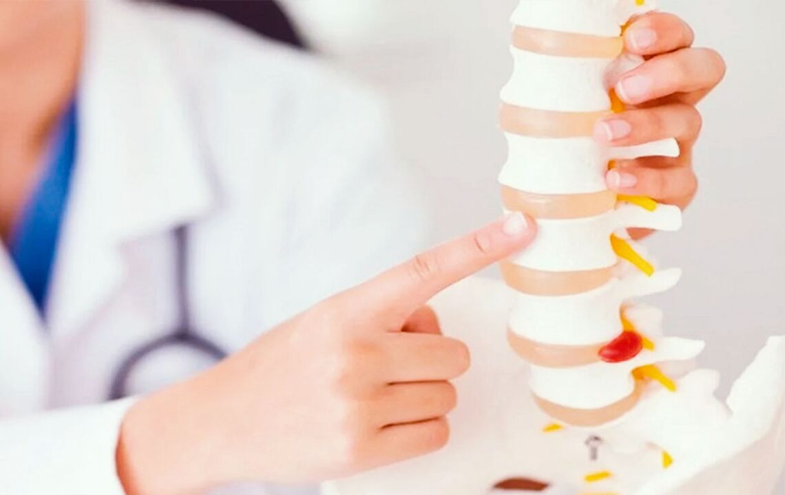 danno alla colonna vertebrale a causa dell'osteocondrosi cervicale