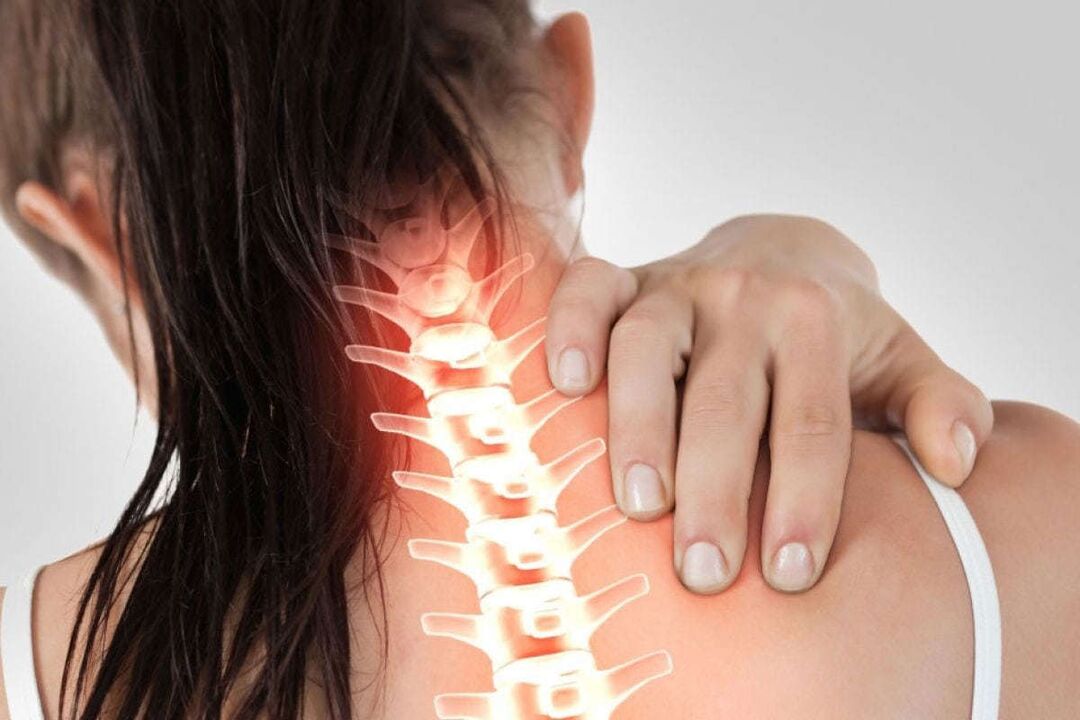 Manifestazioni di osteocondosi cervicale