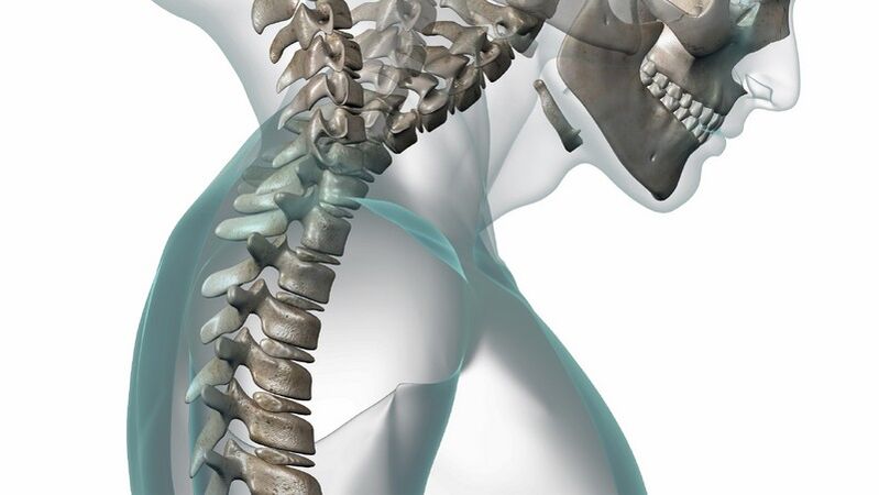 rachide cervicale e osteocondrosi